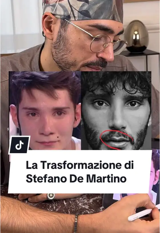 Video TikTok realizzato da Nawave per @dott.antonio.napoletano — 165K visualizzazioni