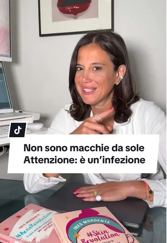 Video TikTok realizzato da Nawave per @inesmordentedermatologa — 516K visualizzazioni
