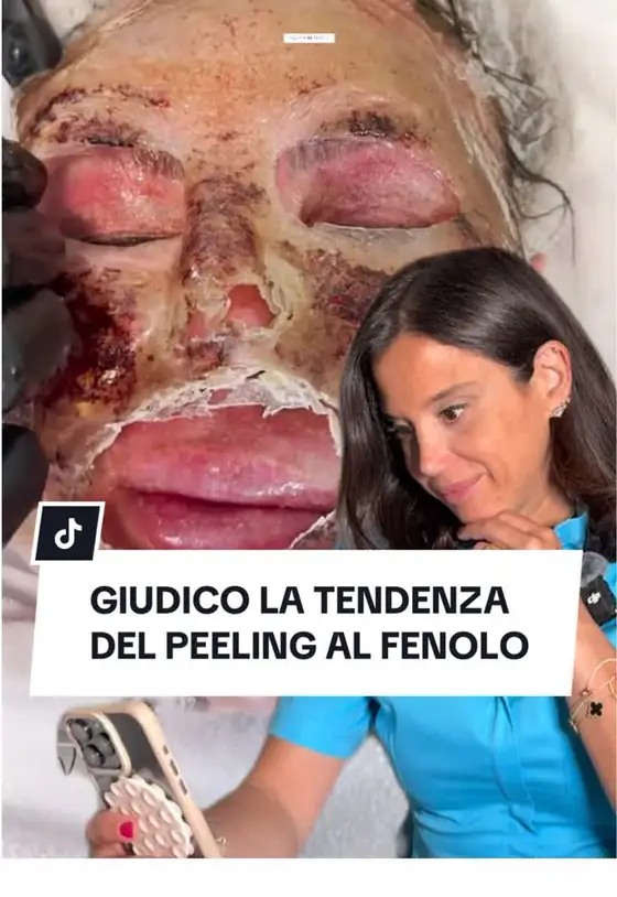 Video TikTok realizzato da Nawave per @inesmordentedermatologa — 463K visualizzazioni