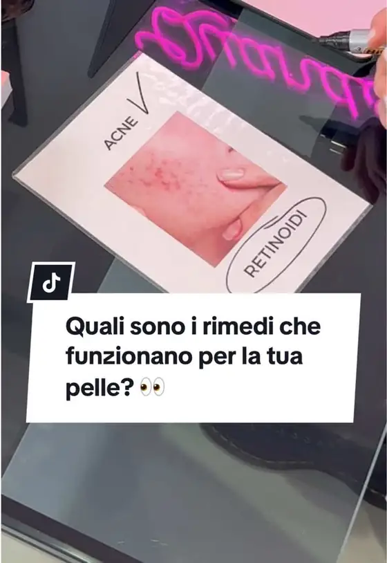 Video TikTok realizzato da Nawave per @inesmordentedermatologa — 647K visualizzazioni