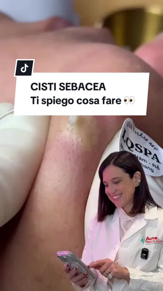 Video TikTok realizzato da Nawave per @inesmordentedermatologa — 440K visualizzazioni